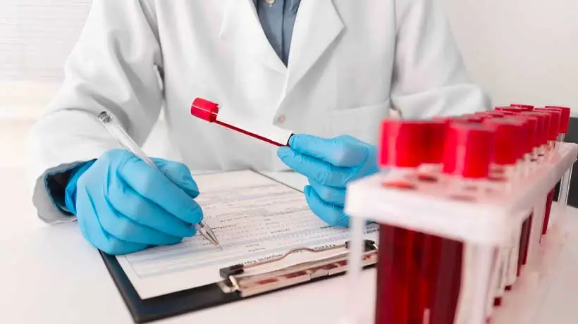 hemograma alterado 7 señales de alerta para considerar