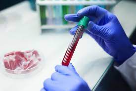 hemograma alterado examen de laboratorio cerca de mi en lima peru