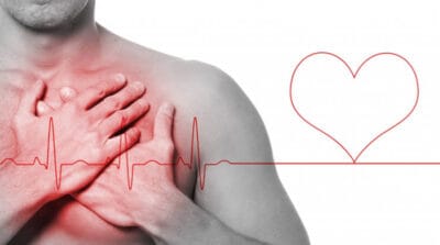 levantamiento de observacion medica cardiologia lima peru