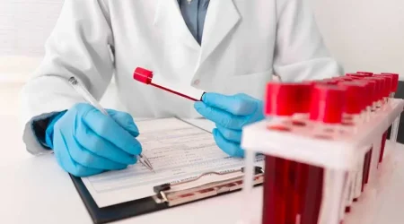 hemograma alterado 7 señales de alerta para considerar